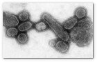 :: Pulse para Ampliar :: Imagen al microscopio electrónico del virus de la gripe espñola de 1918. Recreado en 2005 a partir de restos humanos de un infectado en 1918 en laboratorio por el Dr. Terrence Tumpey para buscar una vacuna eficaz contra el mismo.