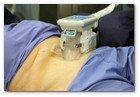 :: Pulse para Ampliar :: Centro Dermitek-SinPelo Barcelona: primer tratamiento de criolipólisis por el Dr. José Azpiazu y la Dra. Nerea Landa