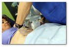 :: Pulse para Ampliar :: Centro Dermitek-SinPelo Barcelona: primer tratamiento de criolipólisis por el Dr. José Azpiazu y la Dra. Nerea Landa