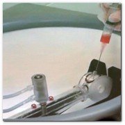 :: Pulse para Ampliar :: Lipofilling Facial: una solución no sólo a la lipodistrofia, que últimamente encuentra su ámbito de aplicación en la cirugía estética. Proceso de extracción de la grasa corporal