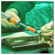 :: Pulse para Ampliar :: Lipofilling Facial: una solución no sólo a la lipodistrofia, que últimamente encuentra su ámbito de aplicación en la cirugía estética. Proceso de extracción de la grasa corporal