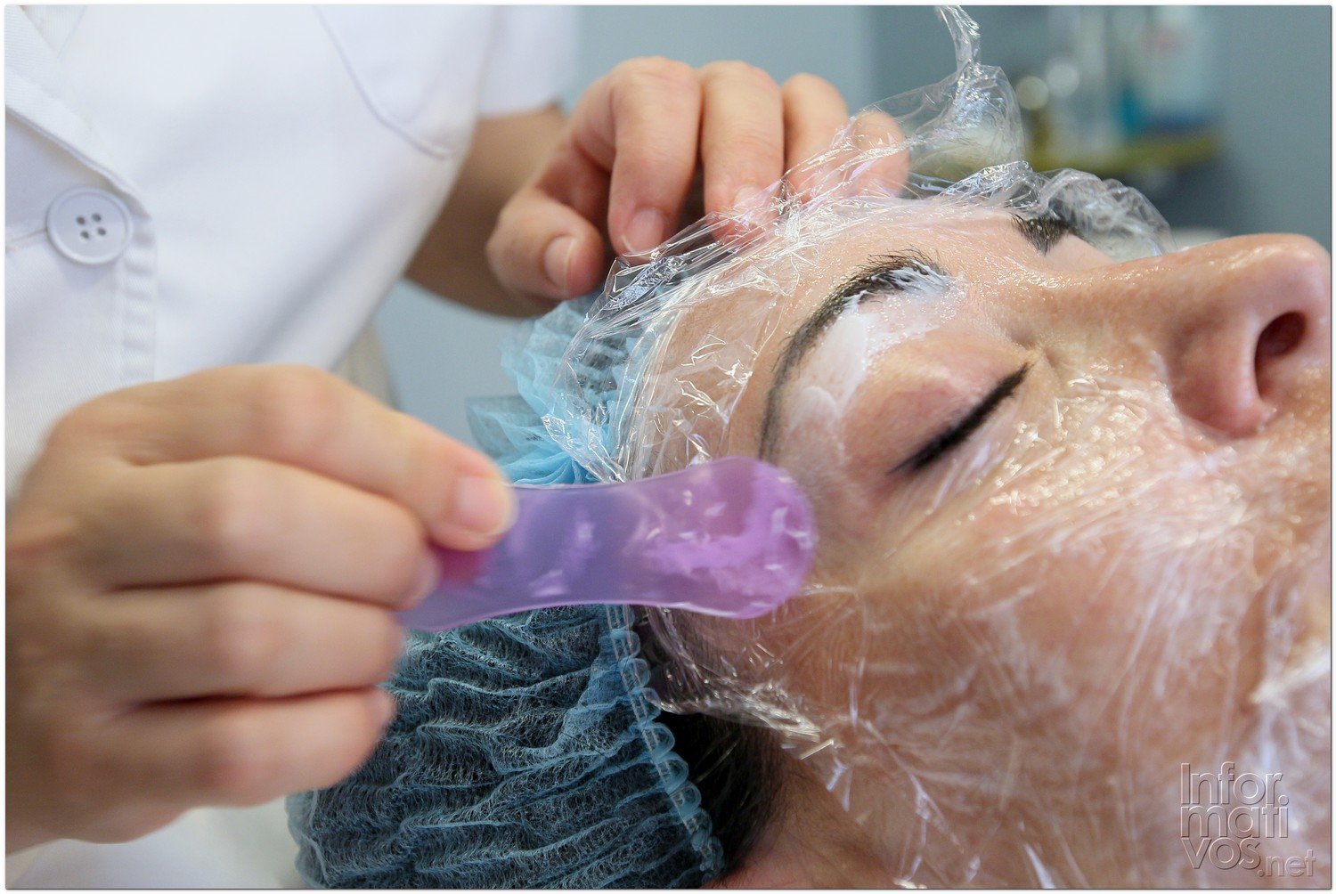 BCN24JUL012.- Tratamiento de Estimulación del colágeno facial en la consulta de la Dra. Nuria Espaulella. Aplicación de una crema anestésica de uso tópico