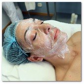 :: Pulse para Ampliar :: BCN24JUL012.- Tratamiento de Estimulación del colágeno facial en la consulta de la Dra. Nuria Espaulella. Aplicación de una crema anestésica de uso tópico